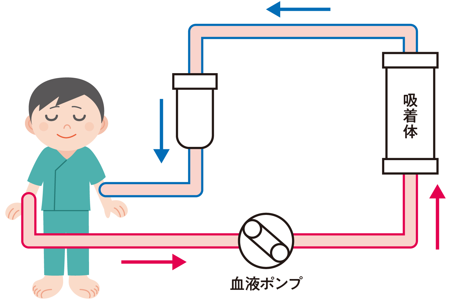 吸着療法